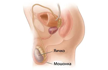 Лечение орхита в Липецке